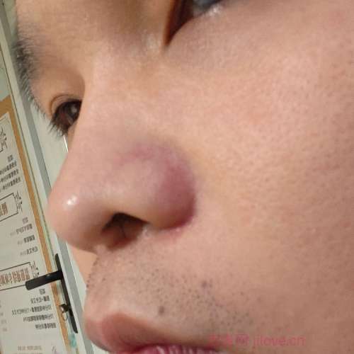 30岁岁江苏单身帅哥 - 黑河吉缘网